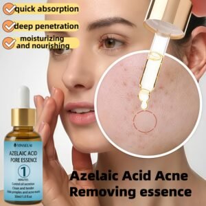 Azelaic Acid/salicylic Acid Removing Essence Can Remove Oil Spots/pockmarks/, Quickly Absorb/take Effect/1 Minute to Control Oil Secretion/clean and Tender Pockmarks, Suitable for Light Cream Skin/the First Choice for Daily Skin Care